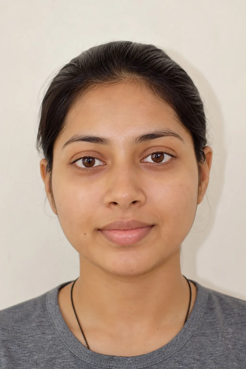 After: clearer looking skin with reduced redness