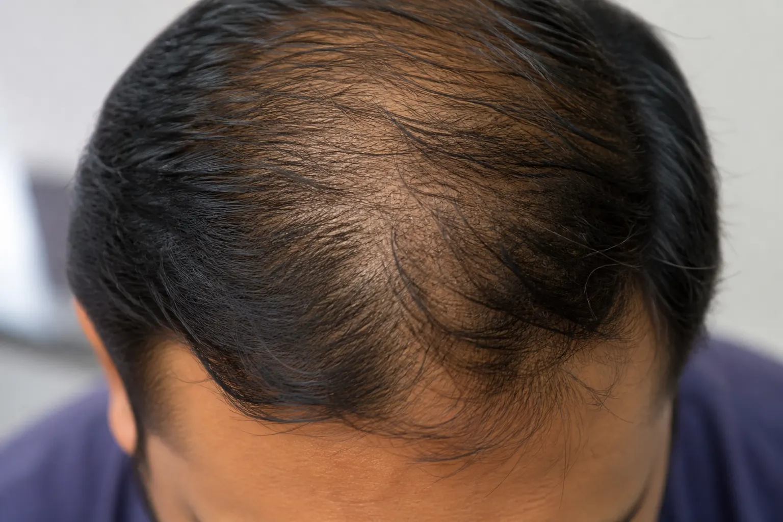 Itchy Scalp — educational image for Hair Loss